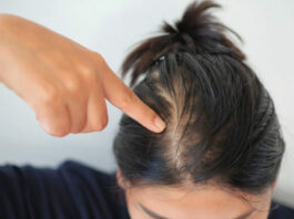 Por que sofremos com a queda de a cabelo e como contornar esse problema?
